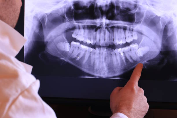 Best Emergency Treatment for Dental Infections or Abscesses in Cascade, IA